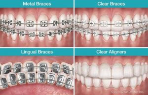 Orthodontics Cumming